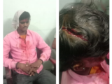 अभनपुर में दबंगई चरम पर: उप-सरपंच का बेटा खुलेआम कर रहा मारपीट, POCSO का आरोपी भी पुलिस की पकड़ से बाहर