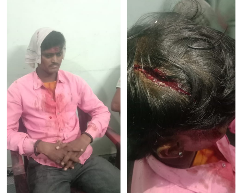 अभनपुर में दबंगई चरम पर: उप-सरपंच का बेटा खुलेआम कर रहा मारपीट, POCSO का आरोपी भी पुलिस की पकड़ से बाहर